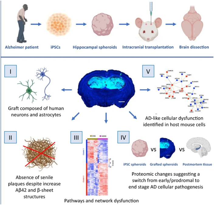 Acta Neuropathol Com：利用源自阿爾茨海默病患者的誘導(dǎo)性多能干細(xì)胞構(gòu)建新的疾病模型，有助更好理解這種疾病如何在大腦中進(jìn)展