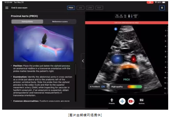 【海外風(fēng)雲(yún)】Butterfly Network 推進人工智能在主動脈瓣篩查中的應(yīng)用